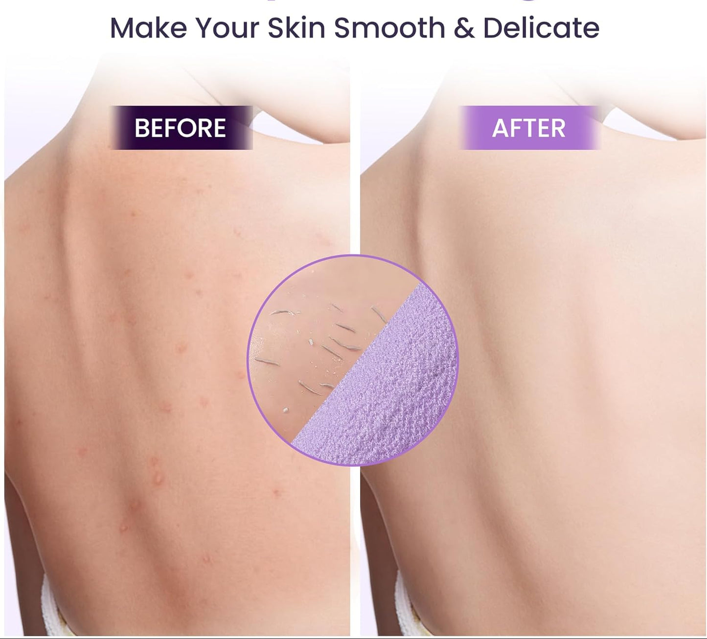 Dluxe Ave. Double-Sided Back Exfoliator Body Scrub Towel, with Handles/ 3 Pcs (BeigePinkPurple)
