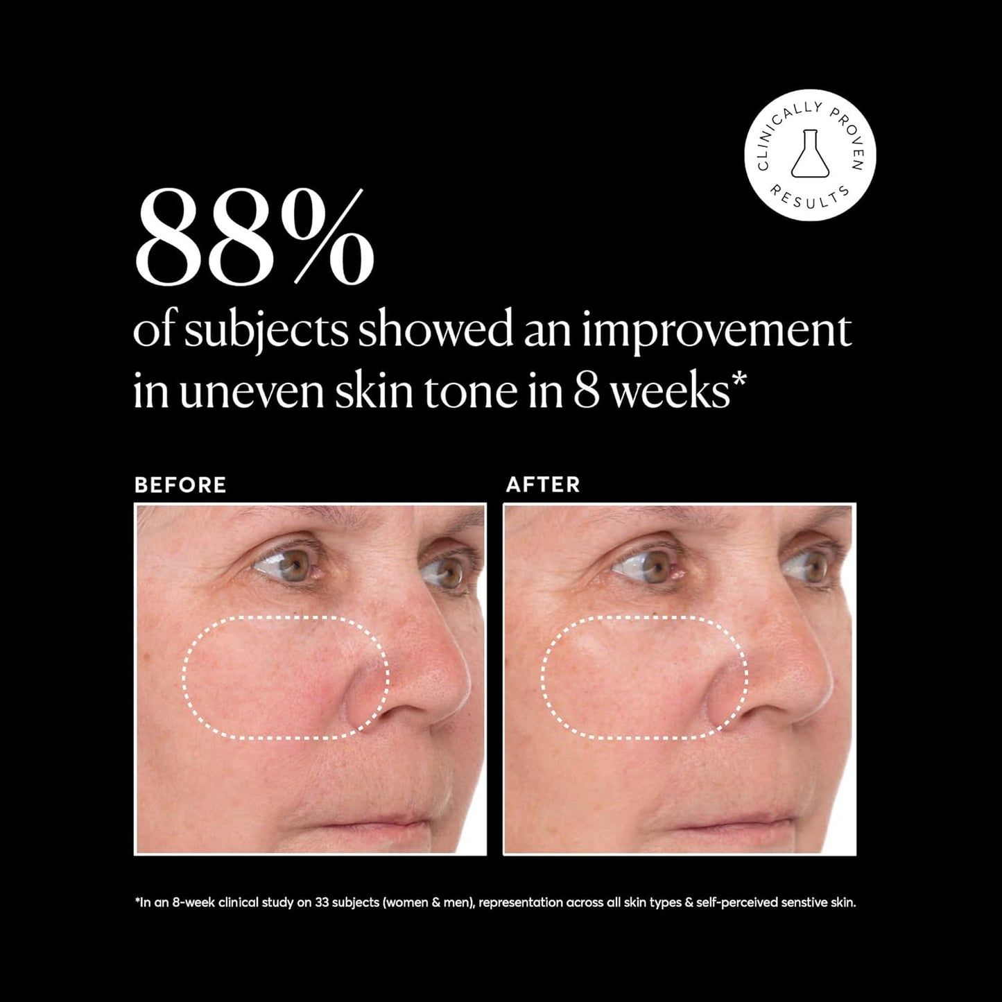 Dluxe Ave. Vitamin C Super Serum Plus/ Retinol Hyaluronic Acid Niacinamide & Salicylic Acid 1 oz