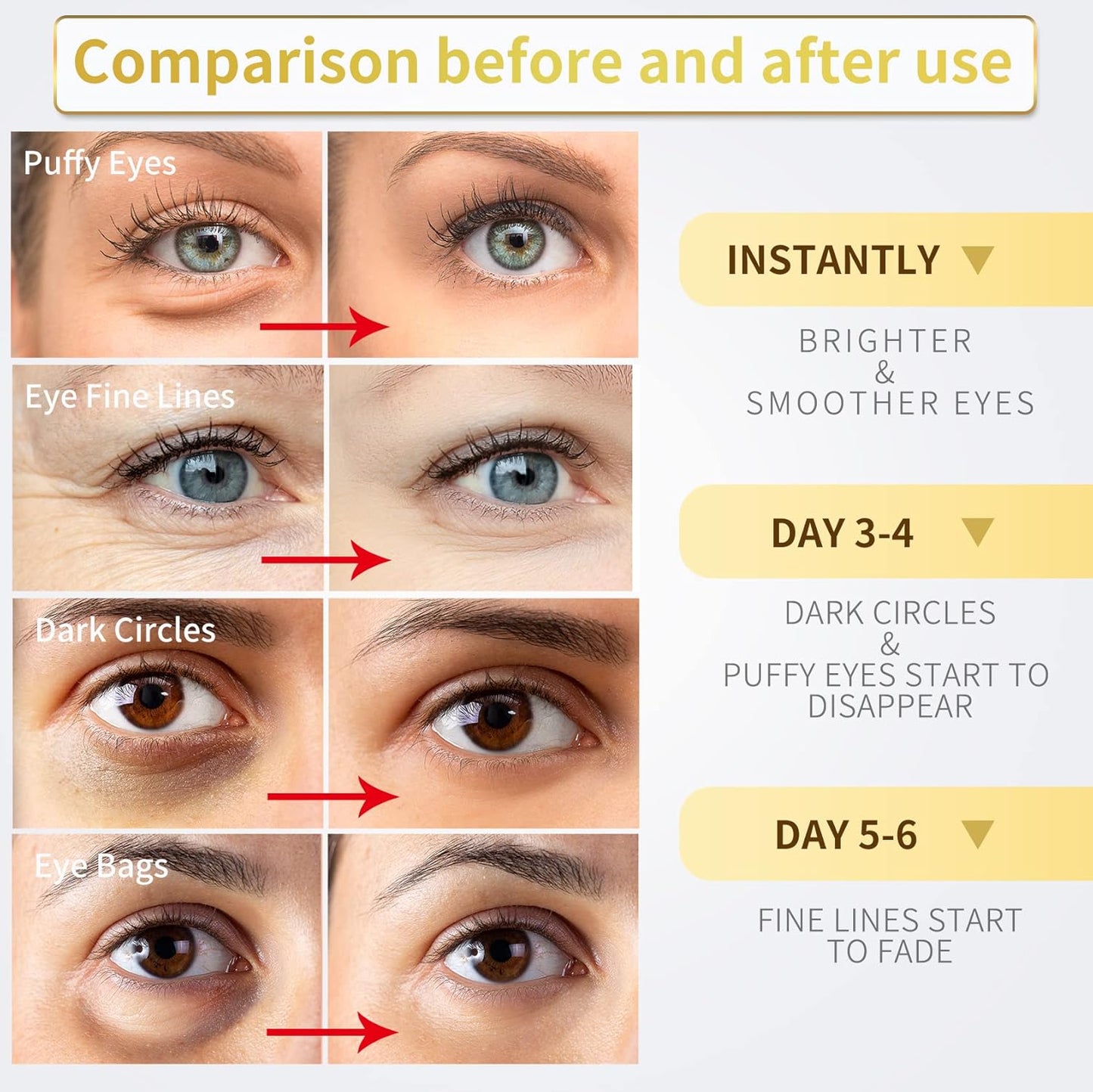Dluxe Ave. NAZANO Under Eye Patches - 60 Pcs - 24K Gold Eye Mask- Puffy Eyes & Dark Circles TreatmentsReduce Under Eye Bags and Smooth WrinklesEye Skin Care Pads With CollagenHyaluronic Acid & Castor Oil