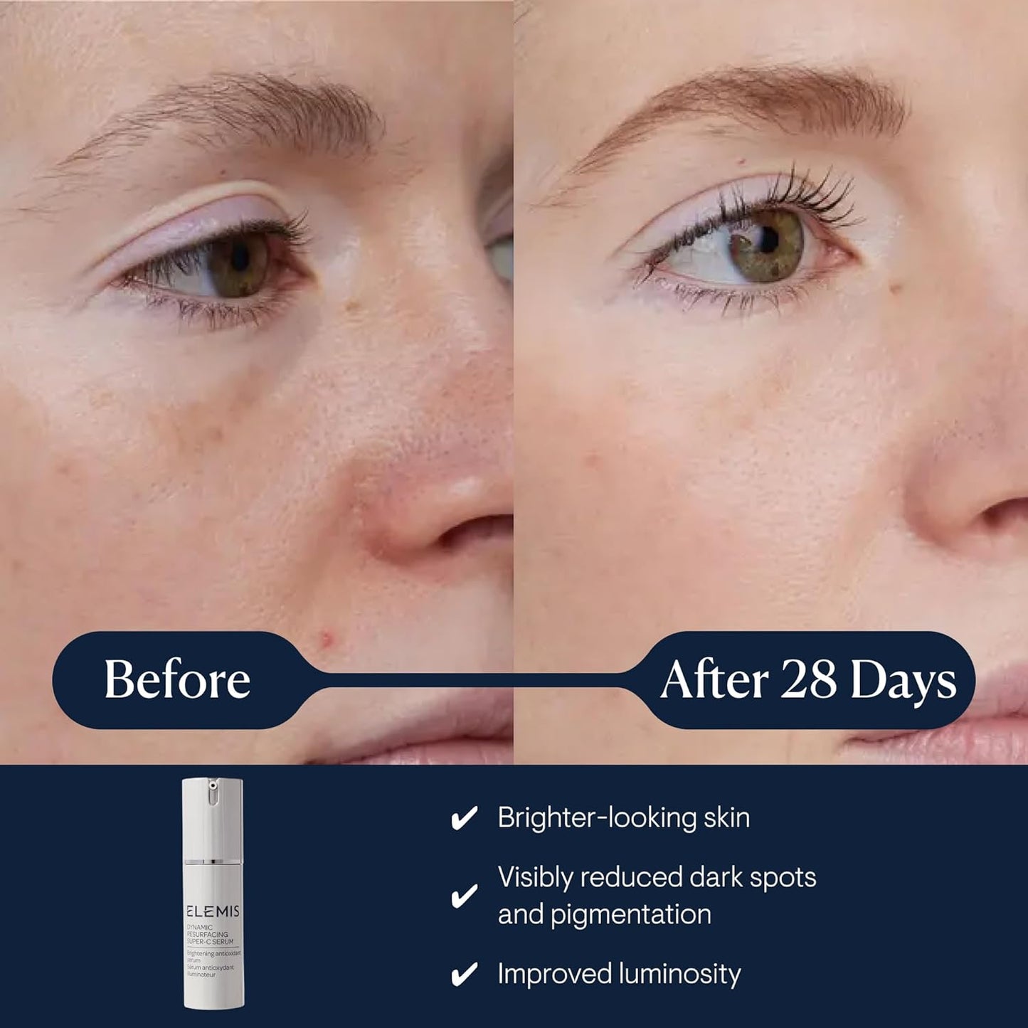 Dluxe Ave. ELEMIS Dynamic Resurfacing Super-C Serum Daily Anti-Aging Antioxidant Serum Brightens Refines and Illuminates Dull Skin with Vitamin C 30 mL