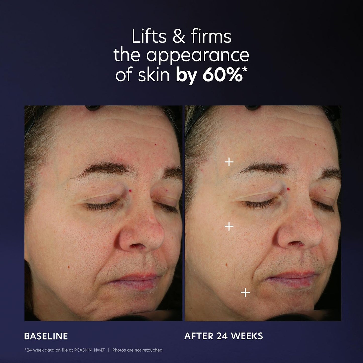 Dluxe Ave. PCA SKIN Pro Max Age Renewal Anti Aging Serum Anti Aging Face Serum for Reducing Wrinkles and Sagging Skin Helps Lift and Firm Skin on Face and Neck Safe For All Skin Types 1.0 oz Pump Bottle