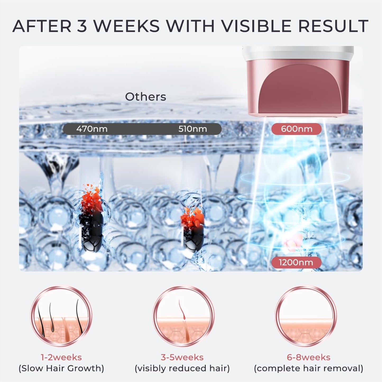 Dluxe Ave. Aopvui Laser Hair Removal for Women and Men IPL with Ice-Cooling System for Nearly Painless And Long-Lasting Result At-Home Permanent Hair Removal Device 999999 Flashes for Whole Body Use