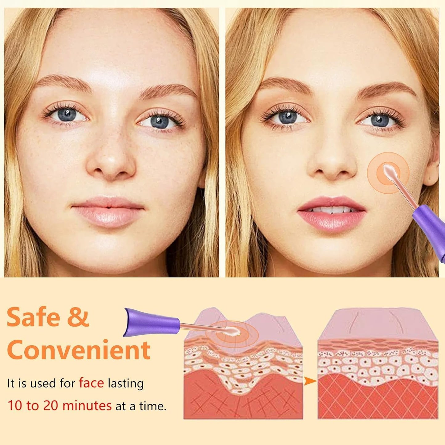 Dluxe Ave. High F Rrequency Facial Wand/ Multi-Function Face Device Machine
