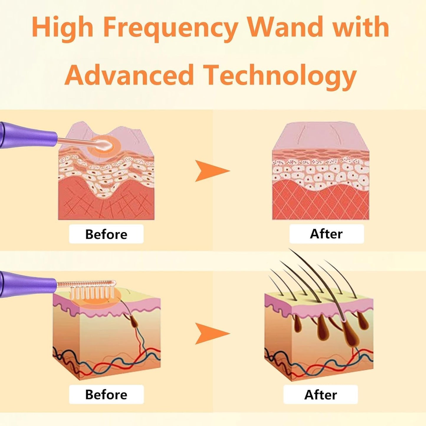 Dluxe Ave. High F Rrequency Facial Wand/ Multi-Function Face Device Machine