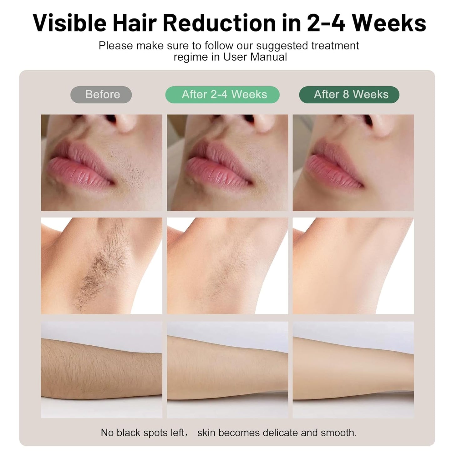 Dluxe Ave. Myelecsio Laser Hair Removal Device IPL Hair Removal Device with Ice Cooling Care Safe long-lasting and Virtually Painless treatment unlimited flashes 1000000+ at Home Use