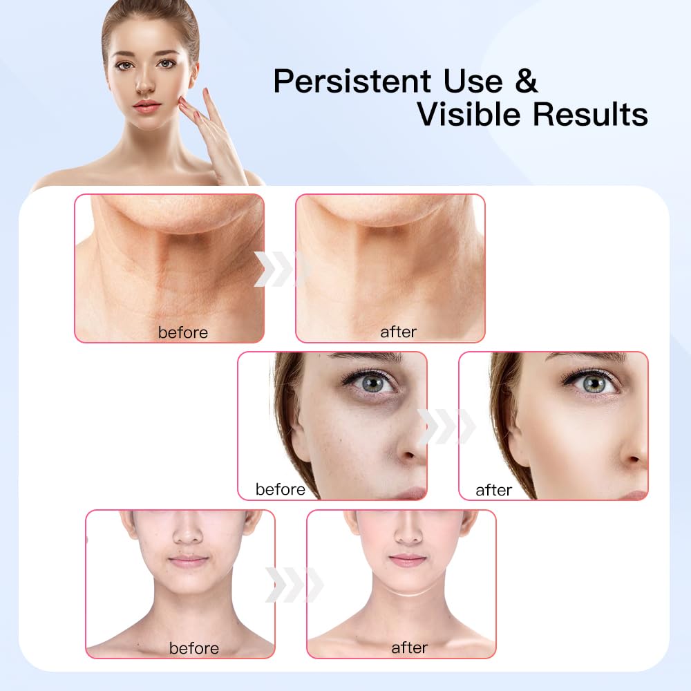Dluxe Ave. Neck Face Massager Multifunctional Facial Massager Face Sculpting Tool for Skin Care and Double Chin with Vibration Thermal (Black Gold)